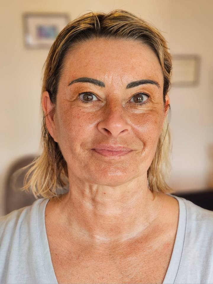 Résonance Sacrée : visage d'une femme blonde après 5 massages bien-être Liftant Japonais